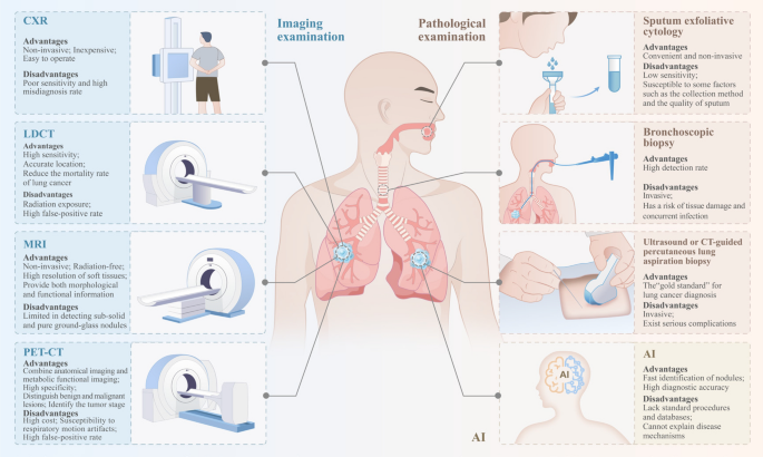 Low-dose CT scan lung screening illustration